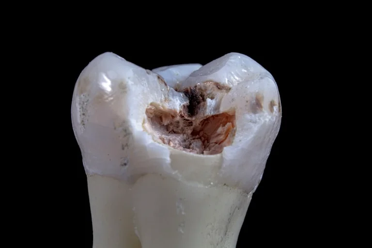 Dreaming About Teeth Falling Out: Meaning, Stress, and Physical Cues